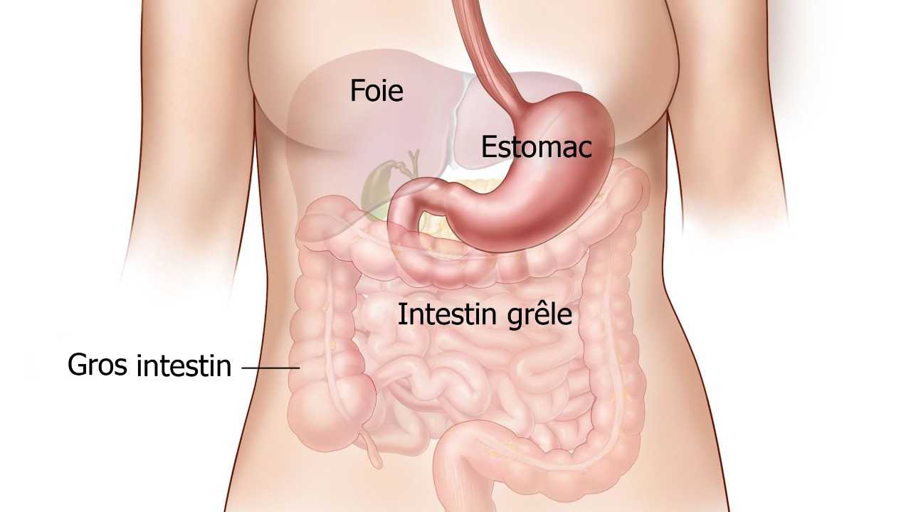 Les 5 stades d'un cancer de l'estomac
