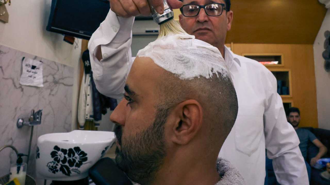 نجاح تجربة جديدة يعطي أملاً بحل مشكلة الصلع عبر التلاعب الجيني