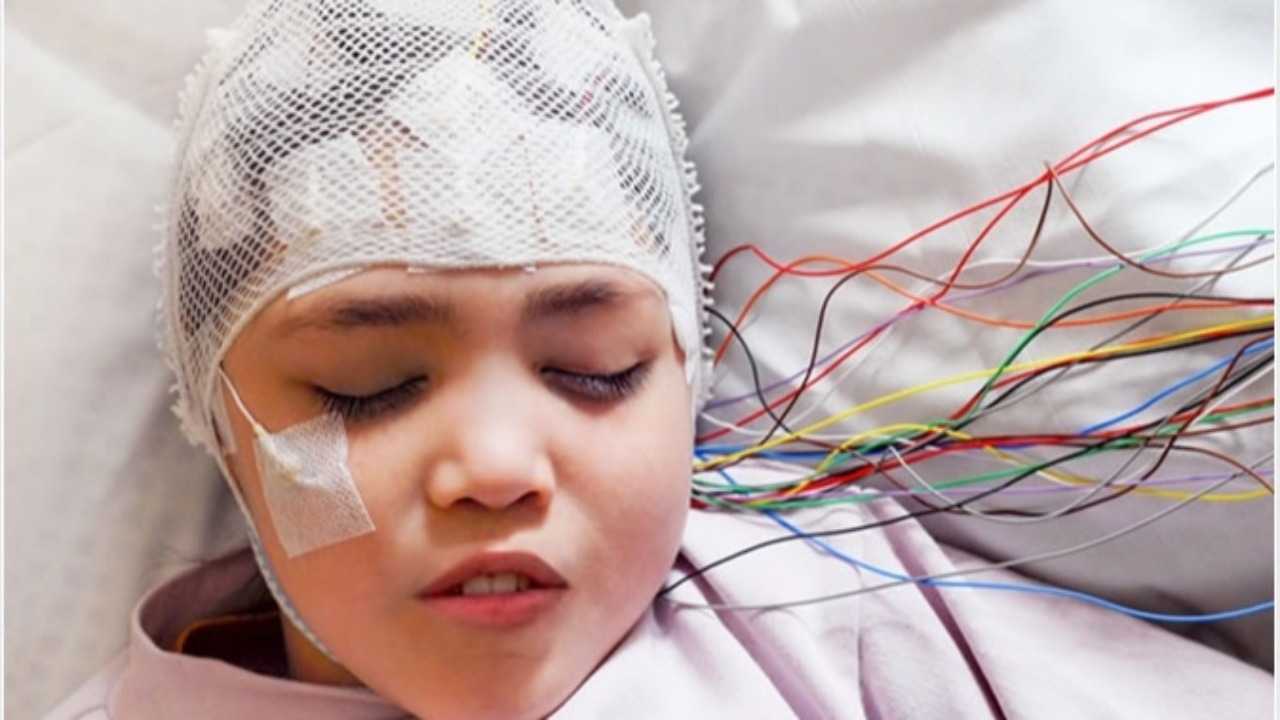 AI tool helps researchers treat child epilepsy