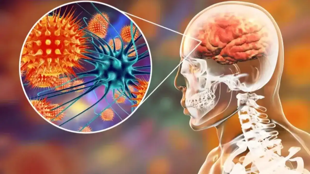 من الخفافيش إلى البشر.. تسجيل إصابات جديدة بفيروس "نيباه" القاتل - Info3 -  The future of news