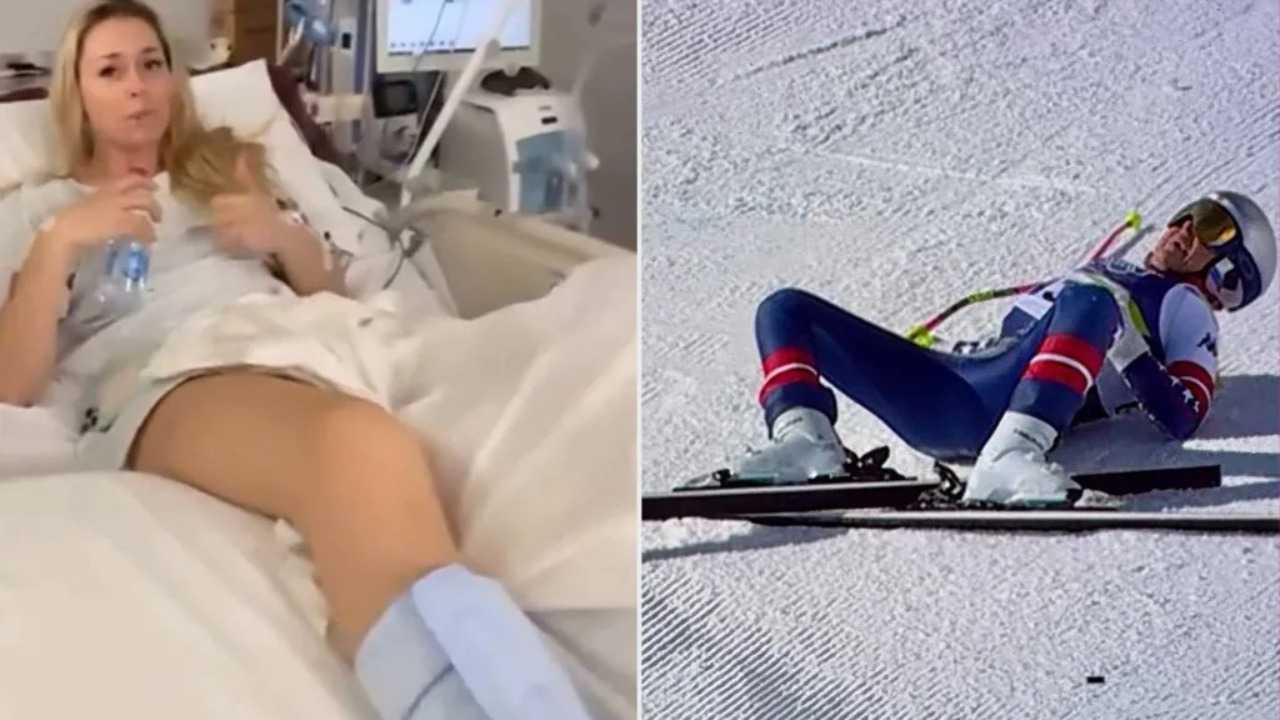 ليندسي فون تنجو من بتر ساقها ورونالدو يعلق